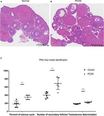 Integrated Transcriptomic and Epigenetic Study of PCOS: Impact of Map3k1 and Map1lc3a Promoter Methylation on Autophagy